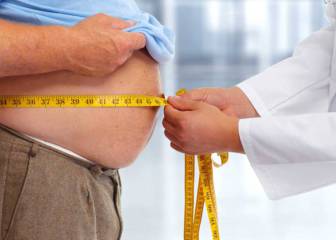 Cirugía de obesidad: todo lo que debes saber