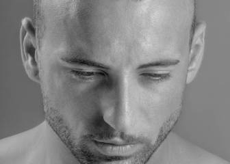 ¿Por qué ir a Turquía si contemplas un trasplante capilar?