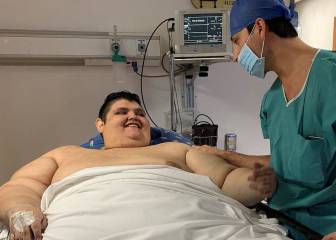 La increíble transformación del hombre más obeso del mundo: de 595 kilos a 304 en dos años