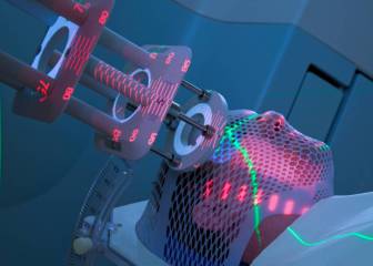 Protonterapia, la nueva técnica para curar el cáncer
