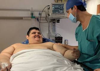 La increíble transformación del hombre más obeso del mundo: de 595 kilos a 304 en dos años