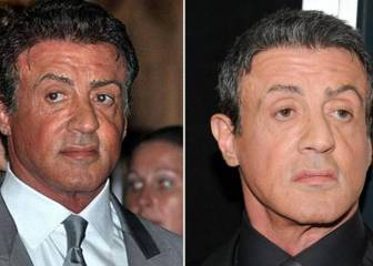Stallone