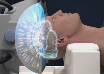 párkinson, temblor, temblores esenciales, salud, ultrasonidos