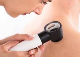 Se inaugura en Madrid la primera unidad integral de cáncer de piel