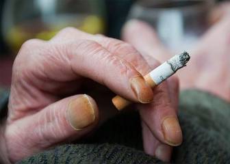 Uñas amarillas y frágiles: los cuidados que debes hacer