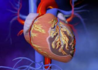 Con un TAC Coronario podrás saber si sufrirás un infarto en 5 años