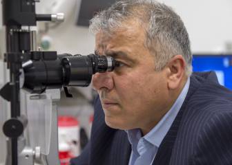 glaucoma, salud visual, salud, vista, ojos, 