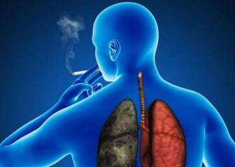 Los oncólogos reclaman más medidas para luchar contra el tabaco