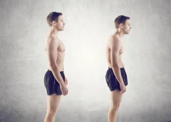 sindrome hombros caidos