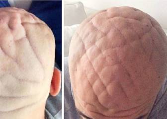 ¿Qué le sucede a este hombre de 37 años para que su cabeza muestre ese aspecto?