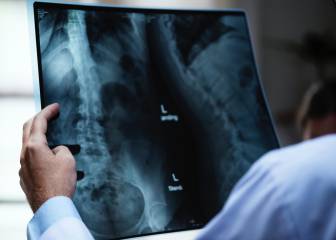 Las radiografías de tórax contienen información de pronóstico oculta