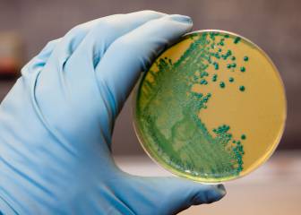 Listeriosis: el brote afecta a 80 personas en Andalucía y hay un caso en Extremadura