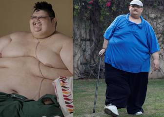 salud, obesidad, juan pedro franco, dietas, cirugía, ejercicio físico