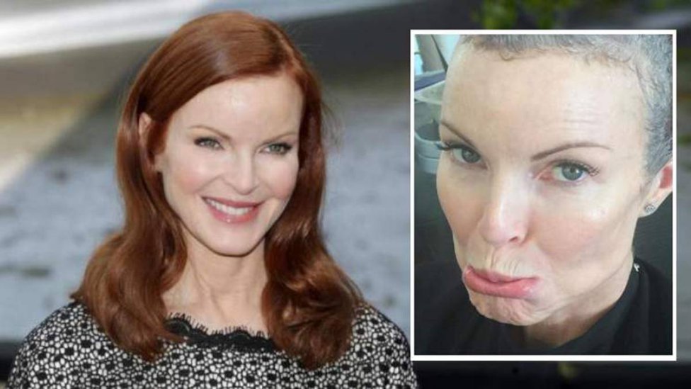 El cncer anal de Marcia Cross: el VPH que pudo haberlo provocado