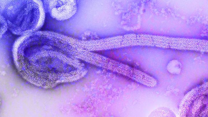 Virus del ébola. 