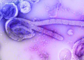 Vista por microscopio del virus del ébola. 