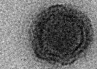 Descubren el yaravirus, un virus de origen desconcertante