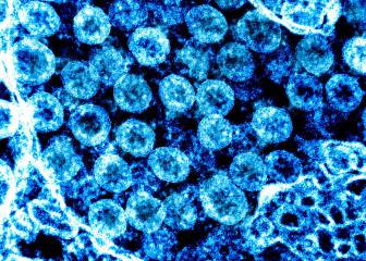 ¿Es el coronavirus equiparable a una gripe? Diferencias y similitudes