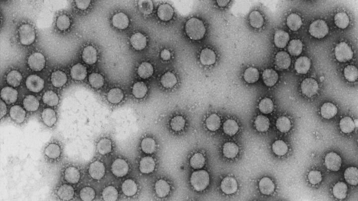 ¿Qué es la ferritina y por qué se relaciona con el coronavirus?