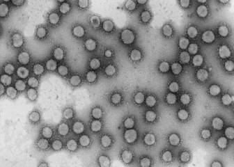 ¿Qué es la ferritina y por qué se relaciona con el coronavirus?