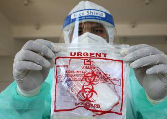 Coronavirus: la enfermedad también afecta al corazón y al cerebro