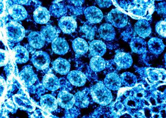 covid-19, estudio epidemiológico