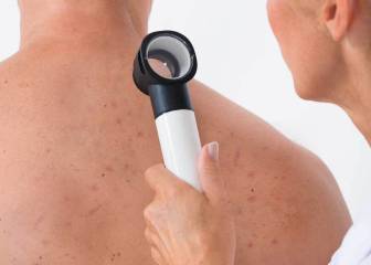 Las cinco manifestaciones que tiene el coronavirus en la piel