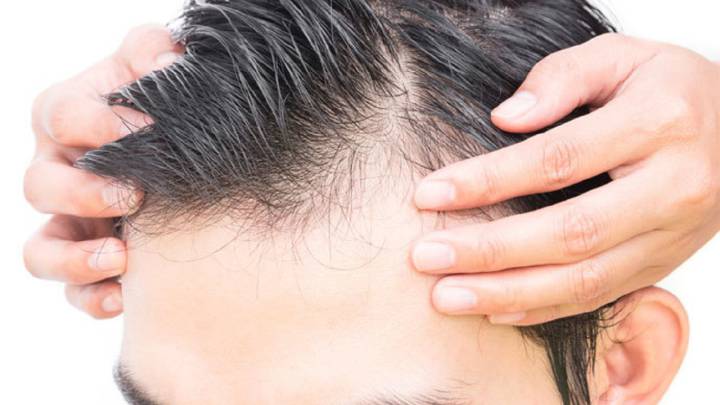 La pandemia puede contribuir a aumentar la caída del pelo