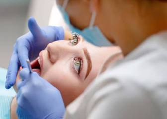 Por qué hay más dientes rotos desde el inicio de la pandemia