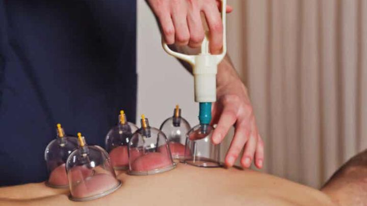 Ventosaterapia: el método para la recuperación muscular de Karim Benzema