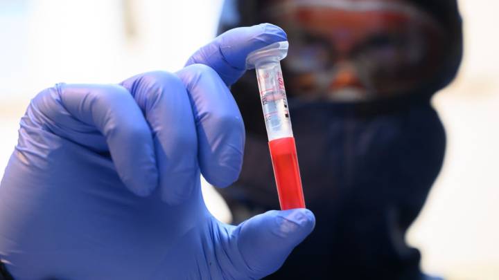 Test PCR coronavirus 2020