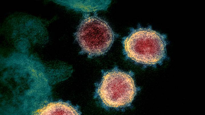 Coronavirus: ¿cuáles son las diferencias entre el SARS-CoV-2 y el COVID-19?