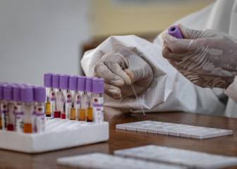 New, dominant coronavirus strain could beat vaccines