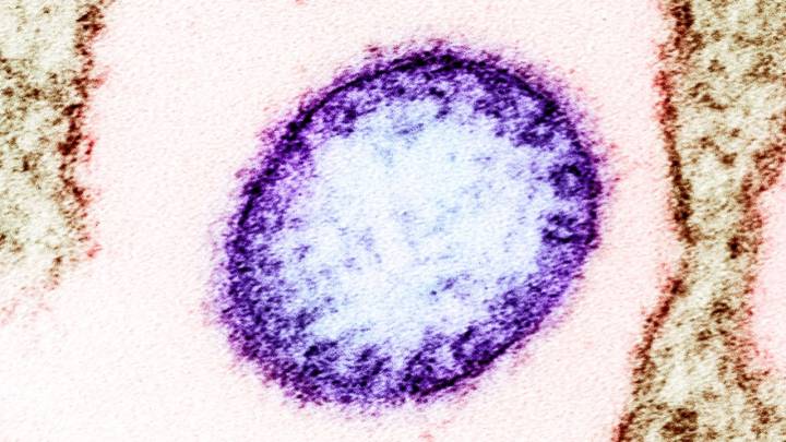 El brote del virus nipah en la India no es de ahora, es de 2018 - AS.com