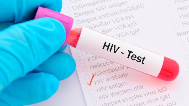 OMS: 73 países pueden quedarse sin fármacos contra el VIH
