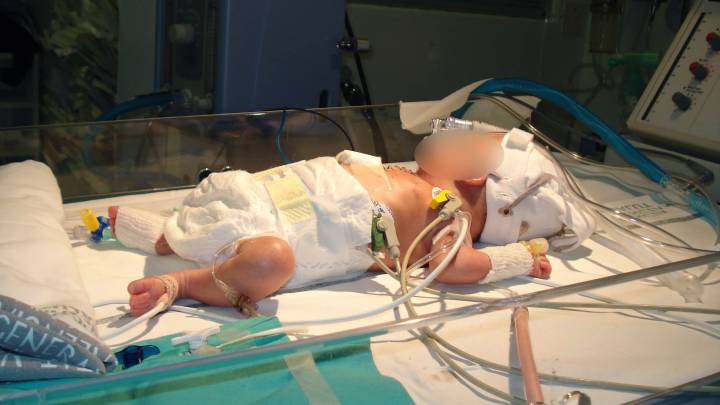Un bebé prematuro de 580 gramos nacido en Perú consigue vencer al coronavirus
