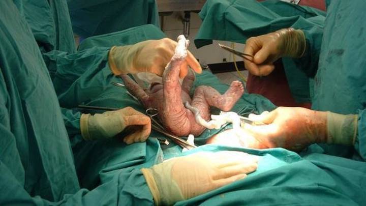 Aumentan los partos de bebés muertos durante la pandemia en todo el planeta