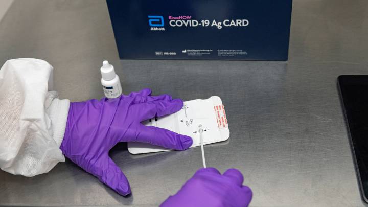 La Agencia Madrileña de Salud Pública advierte sobre el uso de los test de antígenos en Madrid