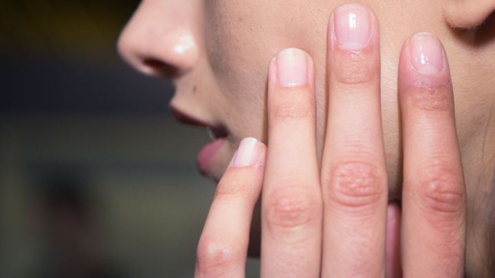 Las 'uñas COVID' se establecen como síntoma habitual. ¿Qué son?
