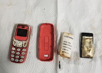 Se traga un Nokia 3310: así se io tuvieron que extirpar
