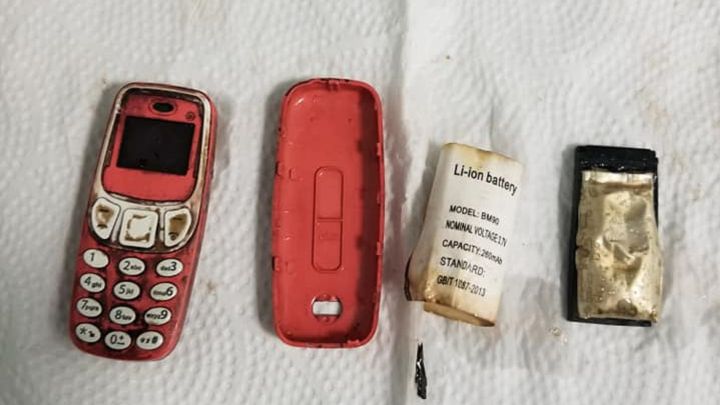 Operan de urgencia a un hombre que se había tragado un Nokia 3310