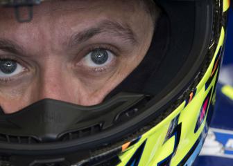 Rossi determined to race despite 'severe' pain