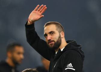 Higuain hopeful of Napoli return despite hand surgery