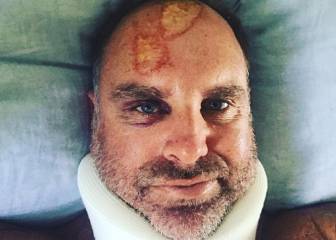 Oz cricketer Matthew Hayden fractures neck in surfing accident