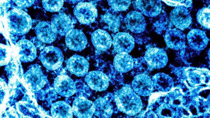 Coronavirus: 7 types of human coronavirus