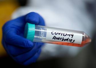 Coronavirus antibody test: what is it and how does it work?