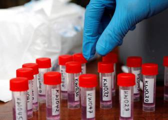 US has developed a coronavirus test that gives results in 24 hours