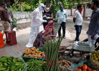 India's Covaxin to be tested on 375 volunteers