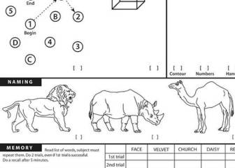 Can I access the cognitive test that Donald Trump did?