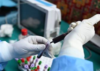 Coronavirus: are mouth lesions another Covid-19 symptom?